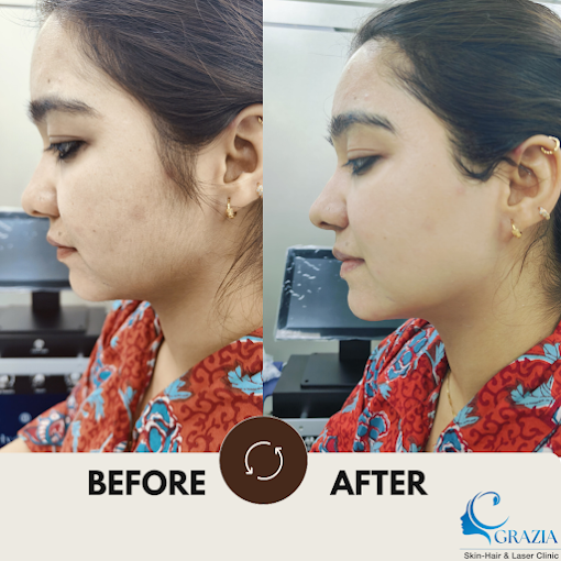 Best Dermatologist in Lajpat Nagar Part-IV