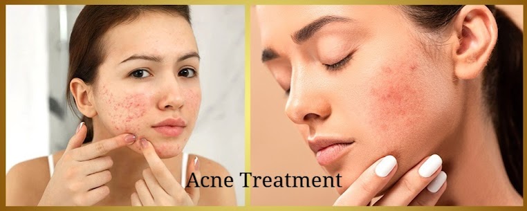 Best Dermatologist clinic near me in New Delhi