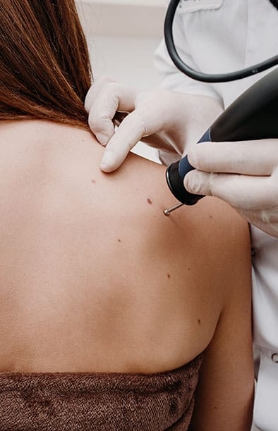 BEST SKIN CLINIC IN DELHI.